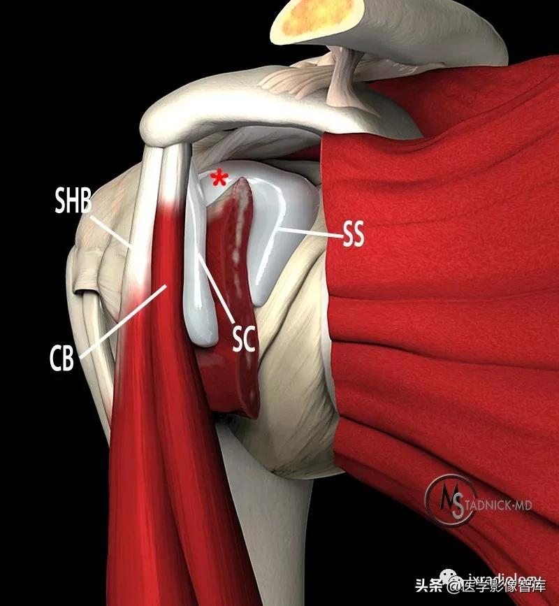 肩关节滑膜解剖,肩关节周围肌肉解剖