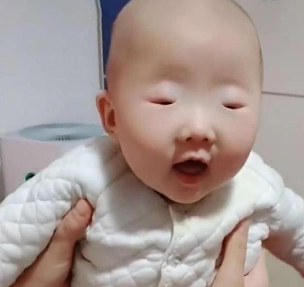 全网眼睛最小宝宝火了，眼睛小的只有一条缝，网友：芝麻吃多了？