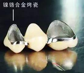 牙齿折断不及时治疗会怎样,牙齿折断了只剩根部