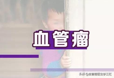 血管瘤会不会自行消退,血管瘤自己消退是不是就是好了