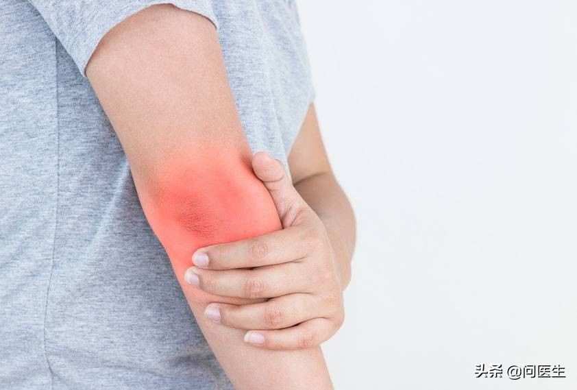 尿酸高脚部有什么反应,尿酸高下肢水肿