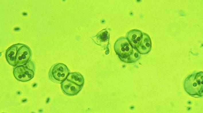 无性生殖到有性生殖的进化,无性繁殖和有性生殖的优点和缺点