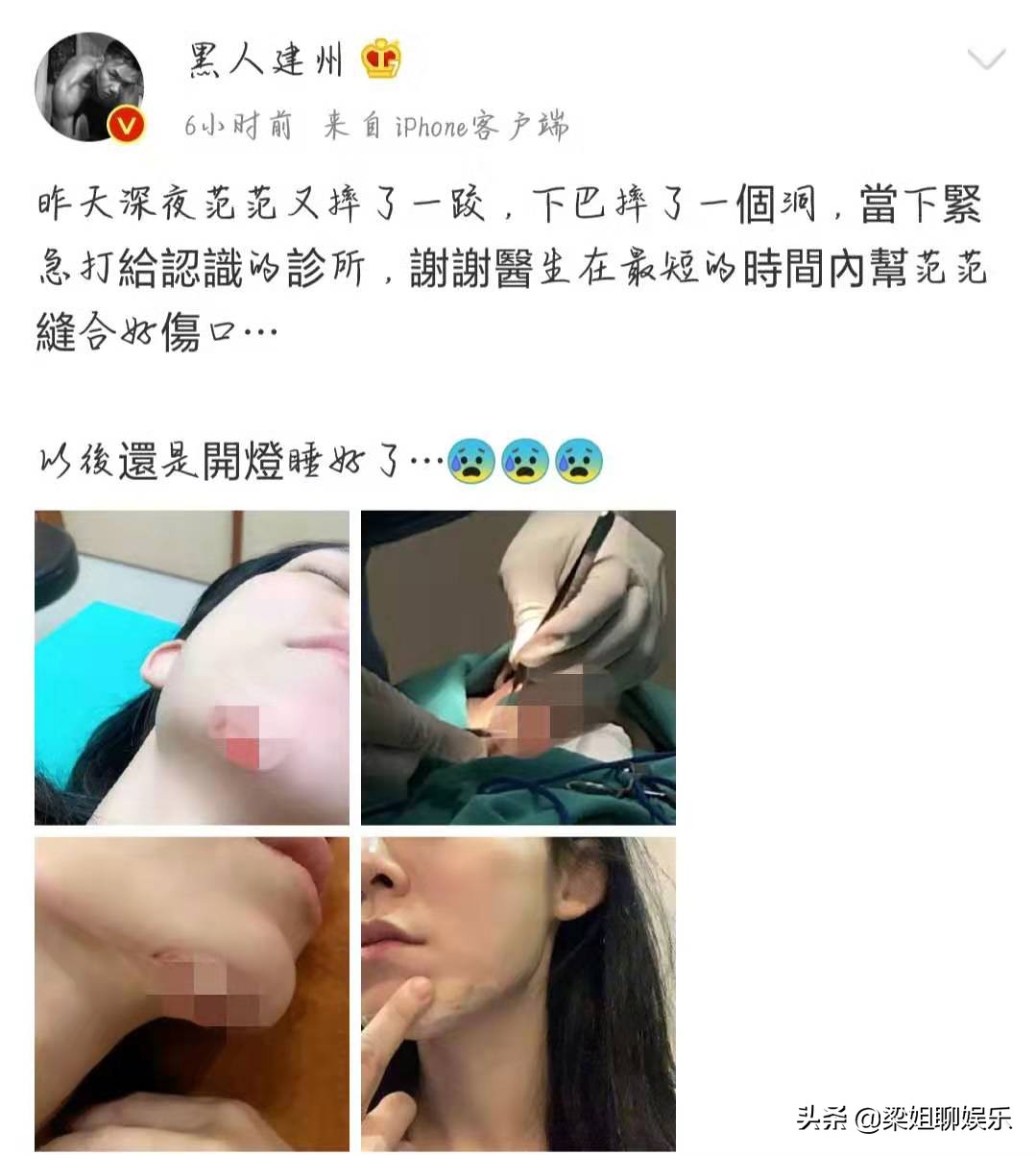 范玮琪摔伤后的图片,范玮琪摔跤最新消息