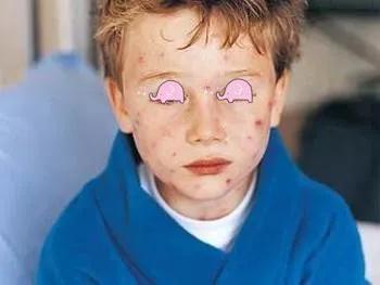 春天，宝宝皮疹的高发期！家长看看怎么辨别皮疹和护理！