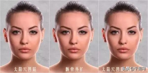 涂抹式太阳穴凹陷填充,40多岁太阳穴凹陷填充