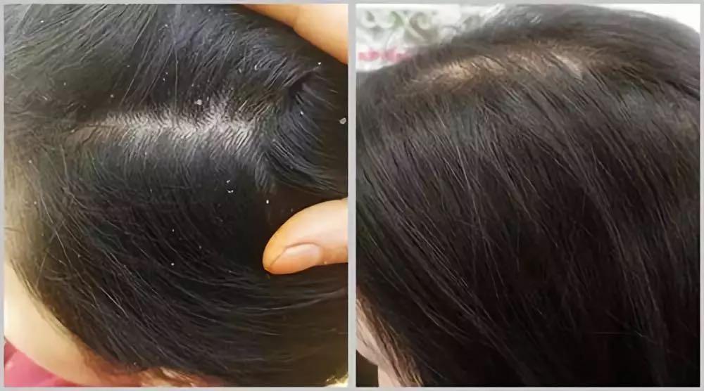 袁咏仪用的洗发水,国货洗发水推荐袁咏仪