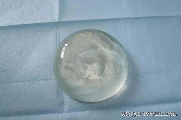 丰胸假体一般有什么牌子,假体丰胸的介绍