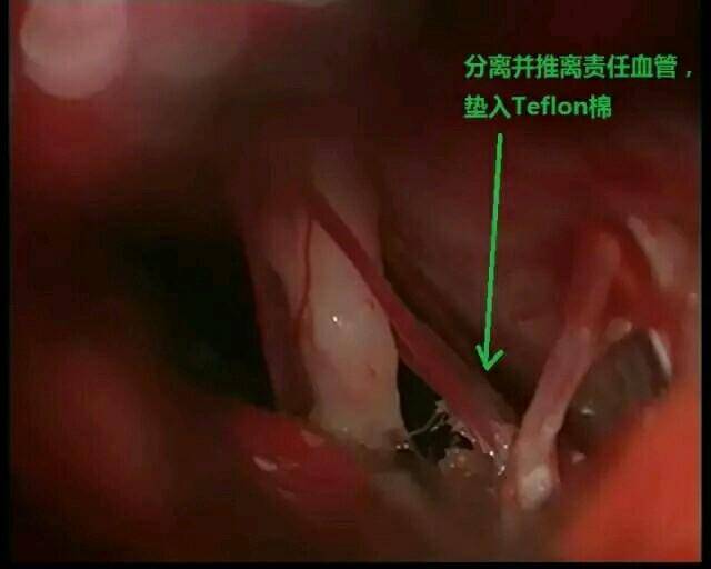 男子意外遭电击变植物人,深圳男子深夜被电击