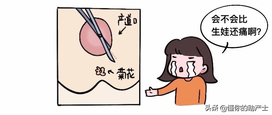 为什么侧切不能打麻药,不打无痛侧切怎么打麻药