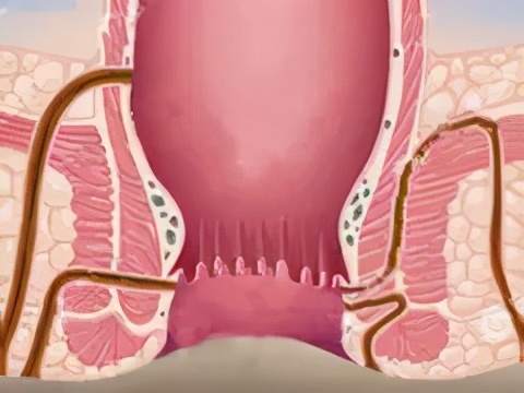 宝宝得了肛瘘保守治疗方法,婴幼儿肛瘘会引起脓肿吗