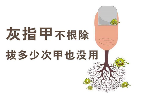 指甲增厚变色一定是灰指甲吗图片,指甲变空了发黄是灰指甲的图