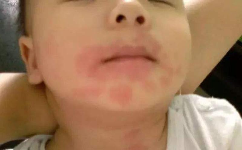 这10种食物不要给1岁内宝宝吃，被列入辅食黑名单，爸妈的要牢记