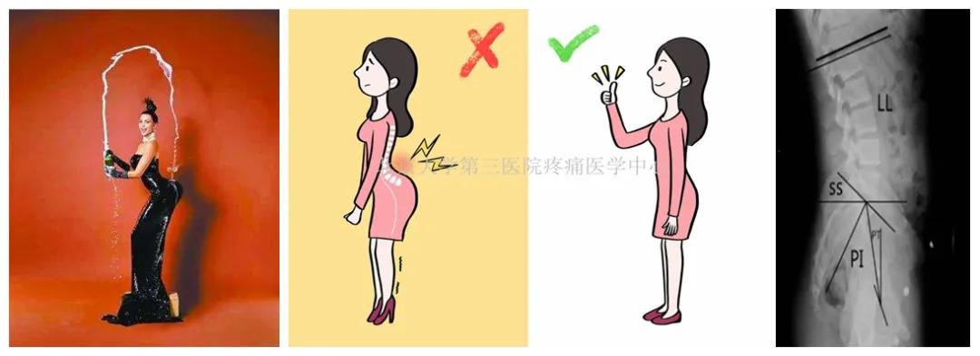 骨科专家讲解久坐的危害,每天做这个动作可以治愈腰椎