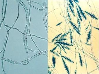 脚气冲天完整版,足癣康能治脚气吗