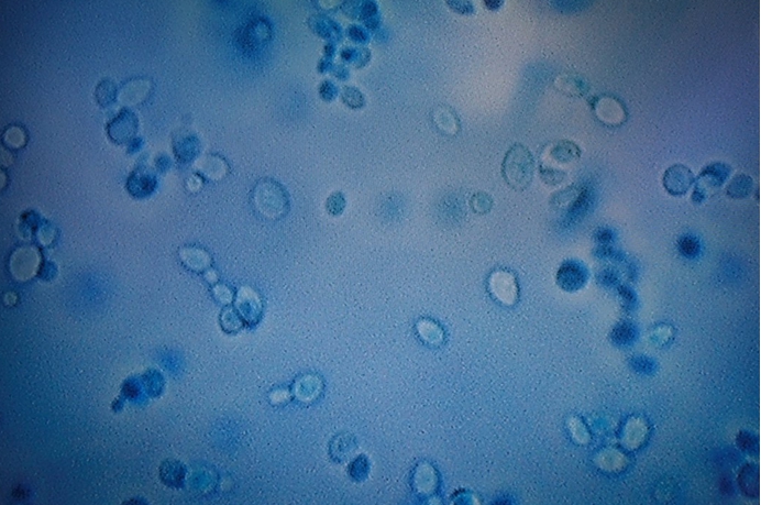 美国真菌感染传播,美国暴发超级真菌传染途径