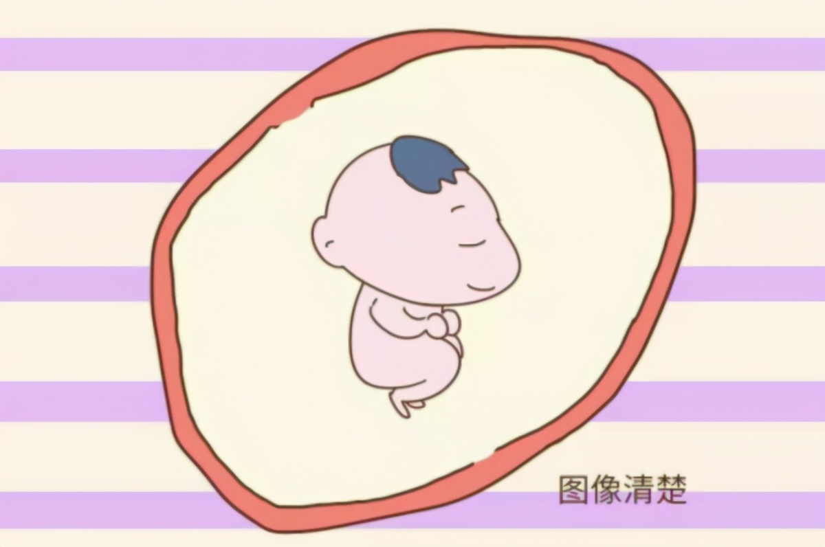 做四维胎儿不配合看不到心脏,做四维彩超胎儿不配合怎么办