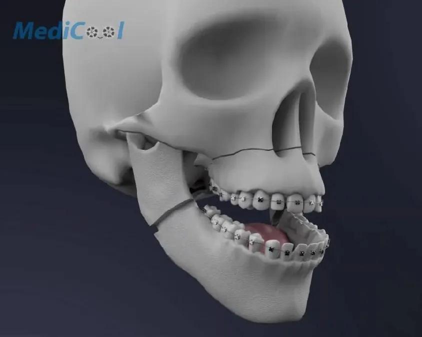 唇形不好看怎么矫正脸型,唇形状不好如何矫正