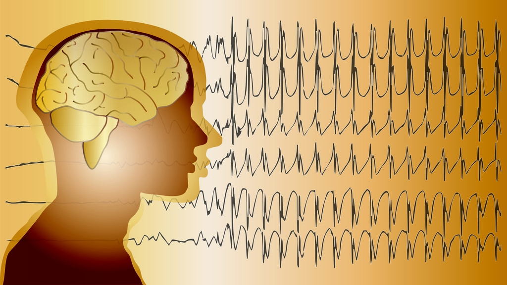 最有效的治疗羊癫疯方法是什么,治疗羊癫疯的费用要多少钱