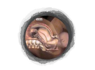 剖腹产宝宝自己从肚子里爬出来?分娩的时候宝宝和你一起在努力