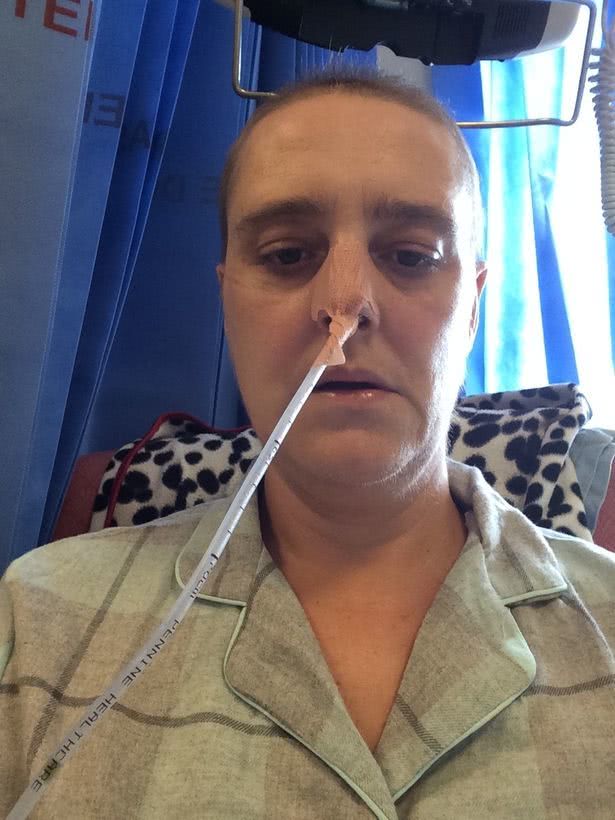 食道癌转移到结肠,食道癌加结肠癌手术