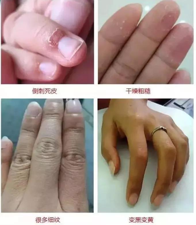 日本蜂王乳面霜,日本的霜好用不过敏干性皮肤用