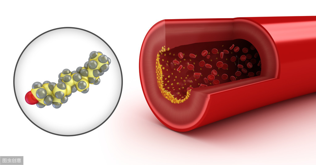 体检检查胆固醇高5.02可以吗,体检胆固醇高如何处理