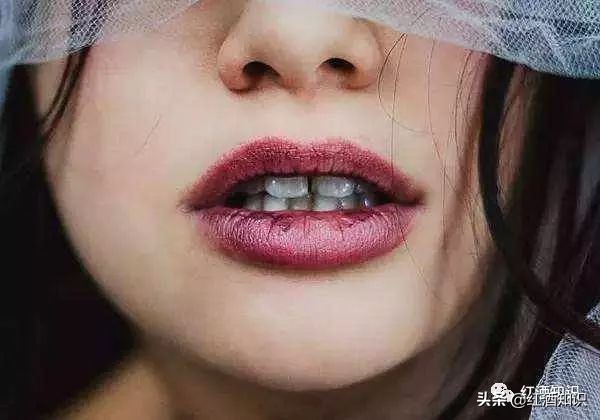 喝红酒舌头变黑正常吗,为什么喝完红酒牙齿和嘴巴是黑的