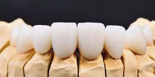 缺牙补牙疼不疼,缺牙补牙多少钱一颗