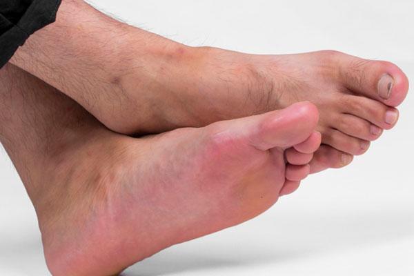 什么原因导致脚臭怎么治,人为什么有脚臭