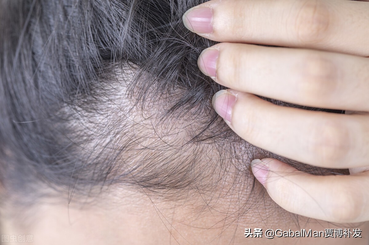 发际线极为危险,发际线有什么讲究