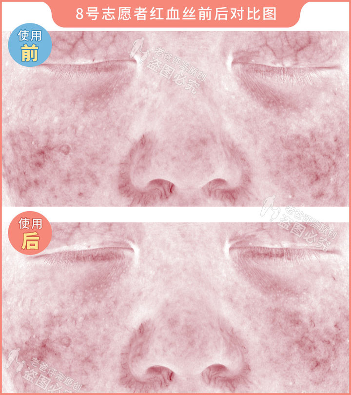 300块的网红美容仪有效果吗,网红家用美容仪测评