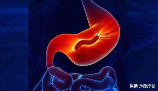 胃癌中的幽门螺旋杆菌可以治好吗,胃癌还有必要治疗幽门螺旋杆菌吗
