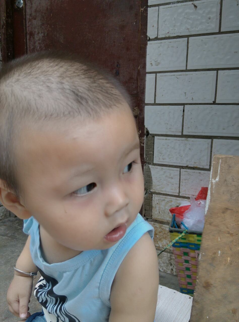 孩子脾胃虚弱脸上有白斑怎么推拿,脸上皮肤粗糙是跟脾胃有关系吗