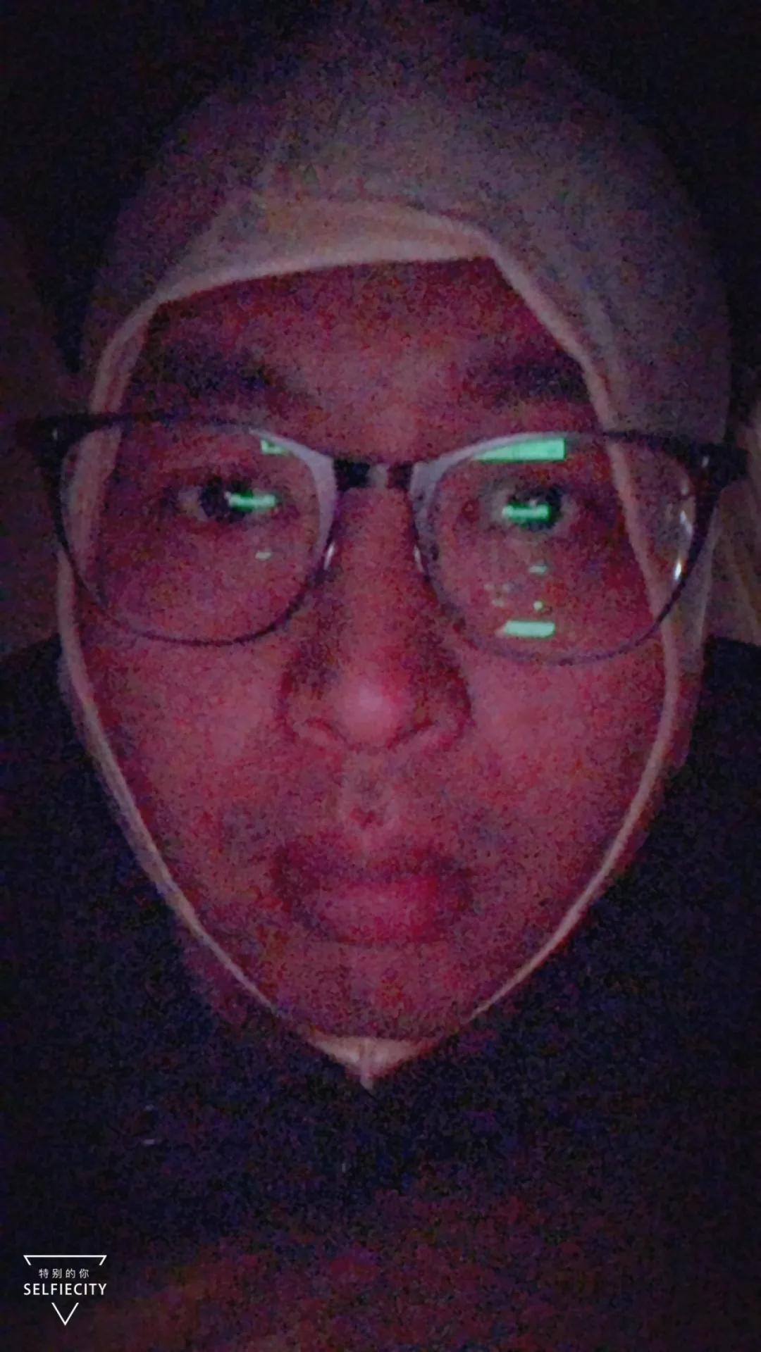 抽脂亲身经历回忆,抽脂血泪史