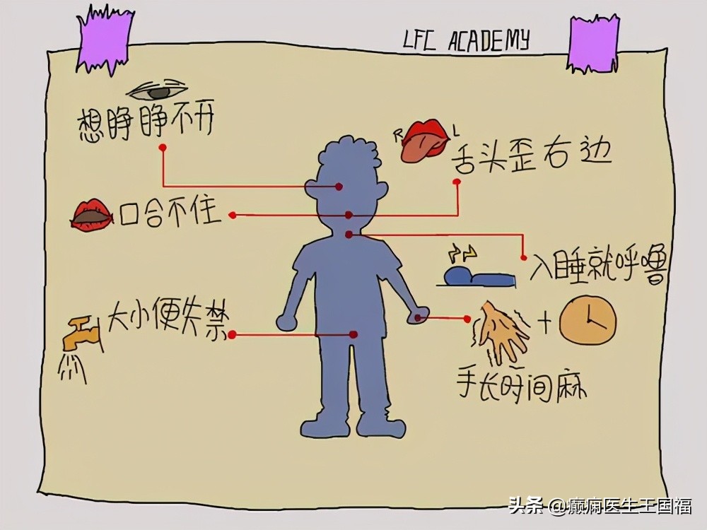 脑卒中头晕,脑卒中的头疼是一点一点的疼