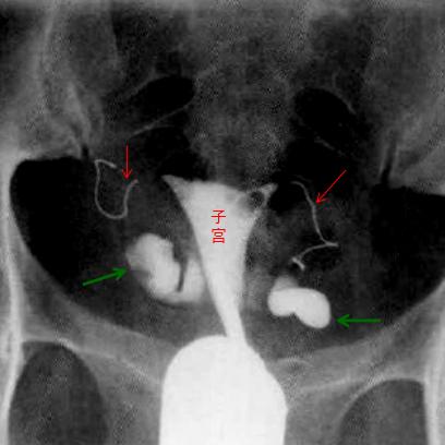 中国治疗不孕不育的送子观音,不孕不育求医之路
