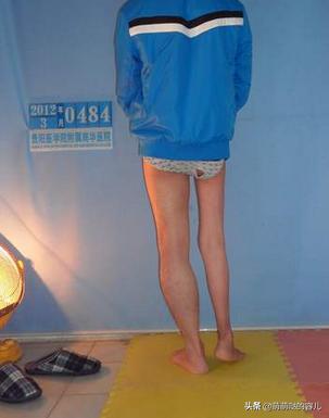 轻微肌肉萎缩症能治愈吗,肌萎缩是什么病能治疗吗