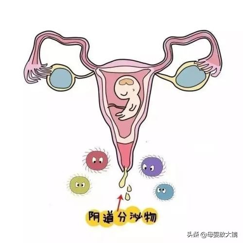 孕早期一旦出现这这些情况，准妈妈们要注意，最好去医院！莫大意