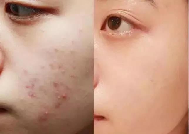 好皮肤怎么样养成的,好脸蛋