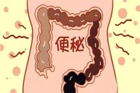 润肠通便的药能治疗便秘吗,上火便秘的中成药