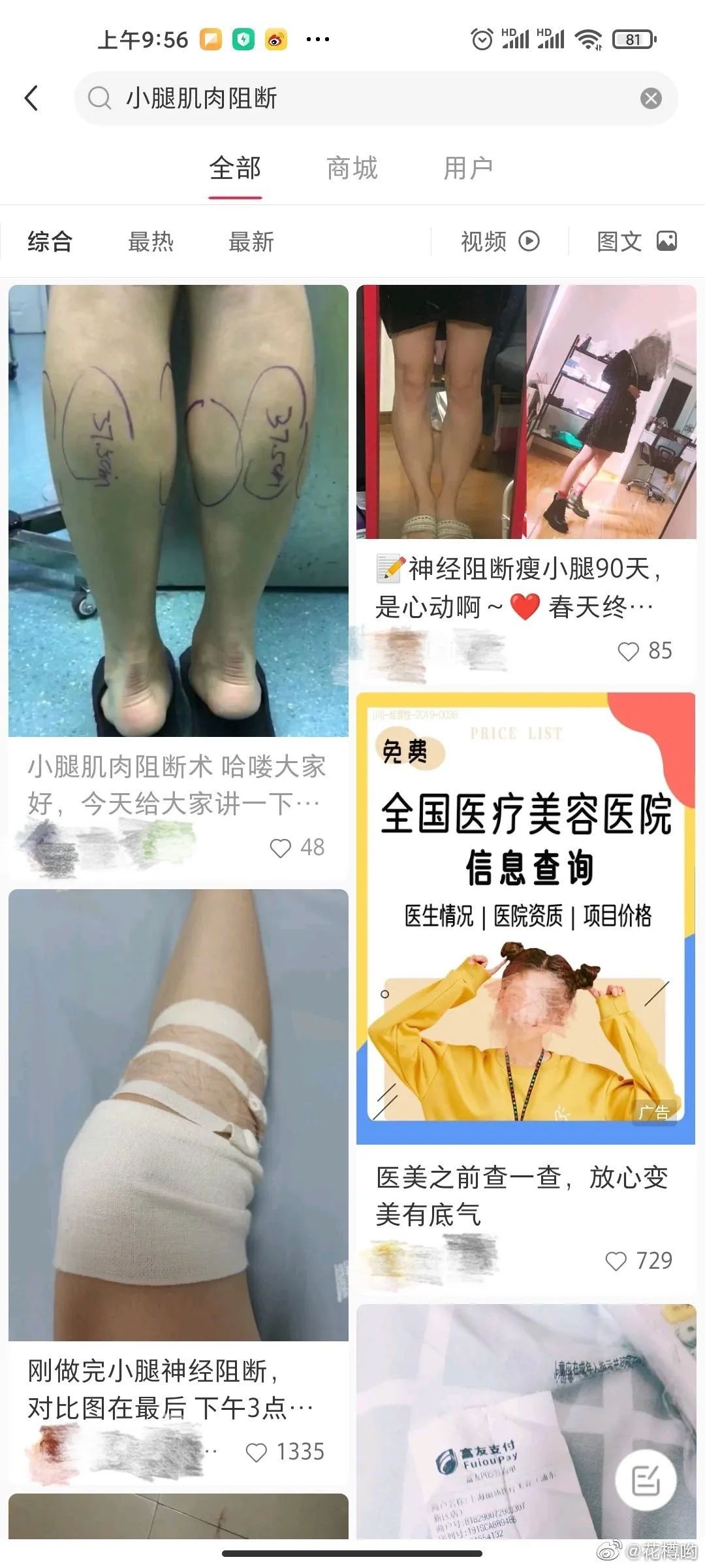 漫画腿蜕变过程,漫画腿怎么整容