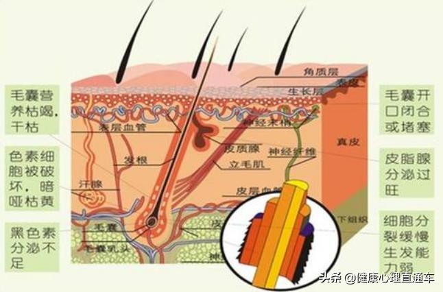 一夜白头可能吗？可能是缺少维生素，教你如何白发变黑发