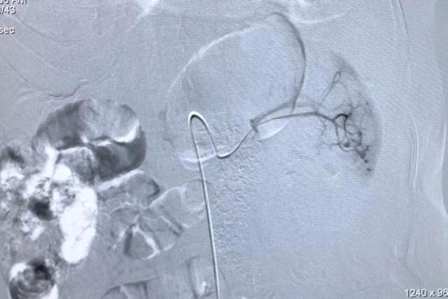 鲁渝扶贫协作简介,鲁渝扶贫协作十年成效卓著