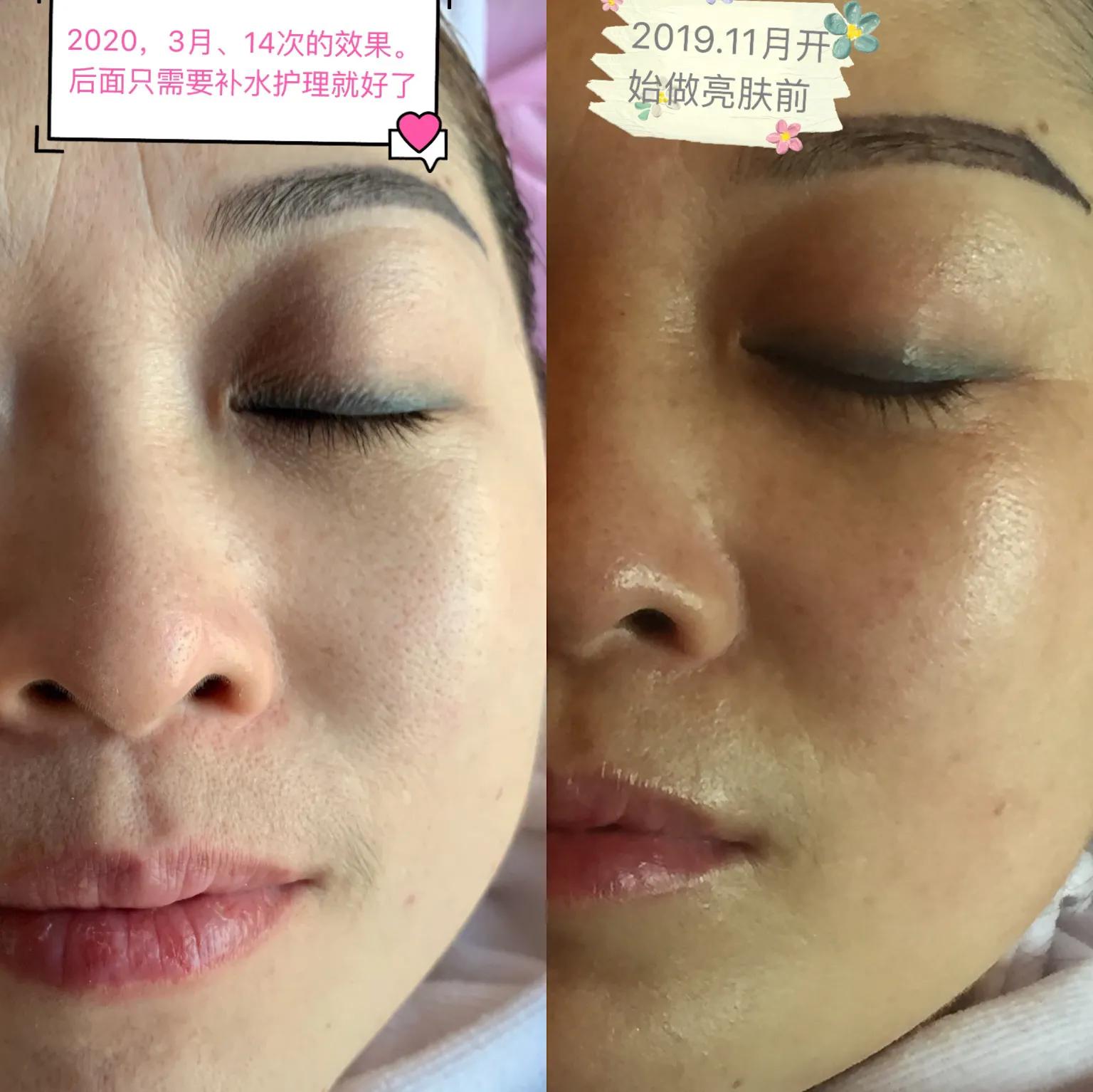 美白攻略2.0教你速成超正冷白皮,三种美白神器让你拥有无瑕雪肌