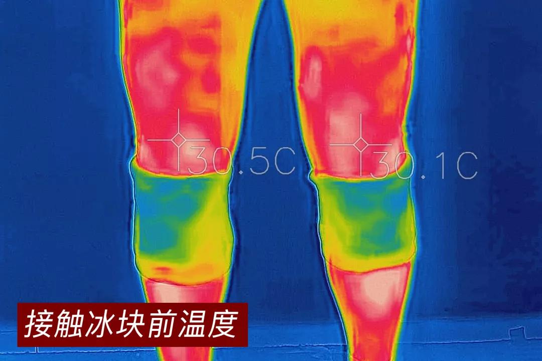 全国有多少关节炎患者,中国关节炎患者超过1亿人