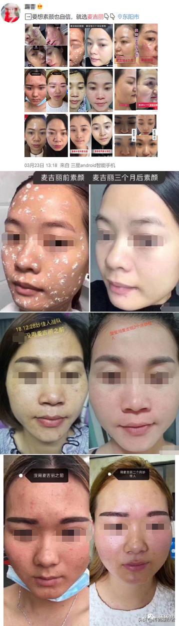 麦吉丽推广宣传,麦吉丽微商清货