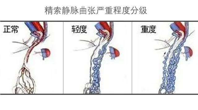 苏州九龙医院三叉神经痛微创手术,苏州九龙医院精索静脉曲张手术