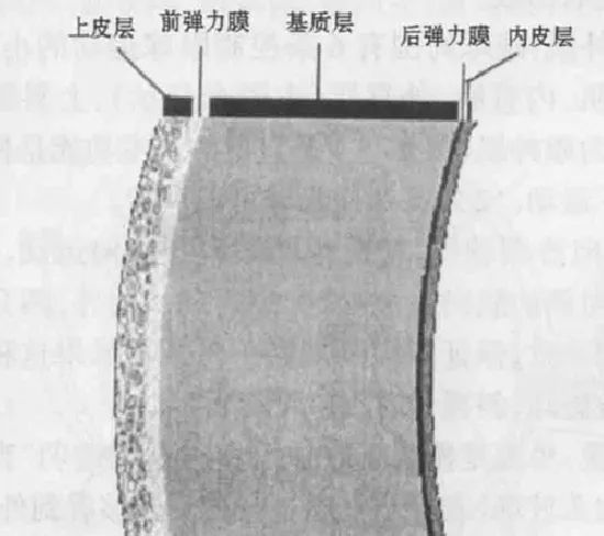 800度近视也能矫正吗,15岁近视800度增长得很快怎么办