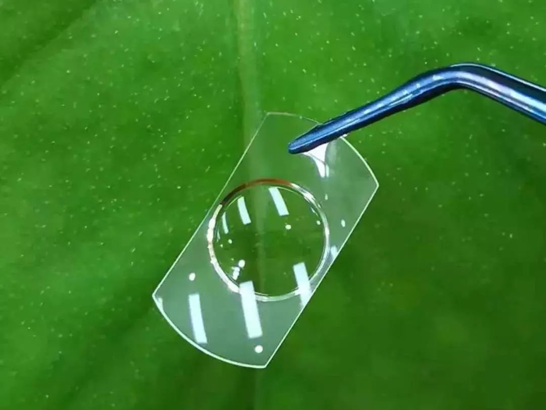 最新黑科技近视手术,黑科技近视治疗