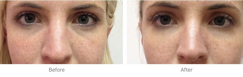 强迫晚婚，控制户口本，当红小花遭极品婆婆在线拆婚！